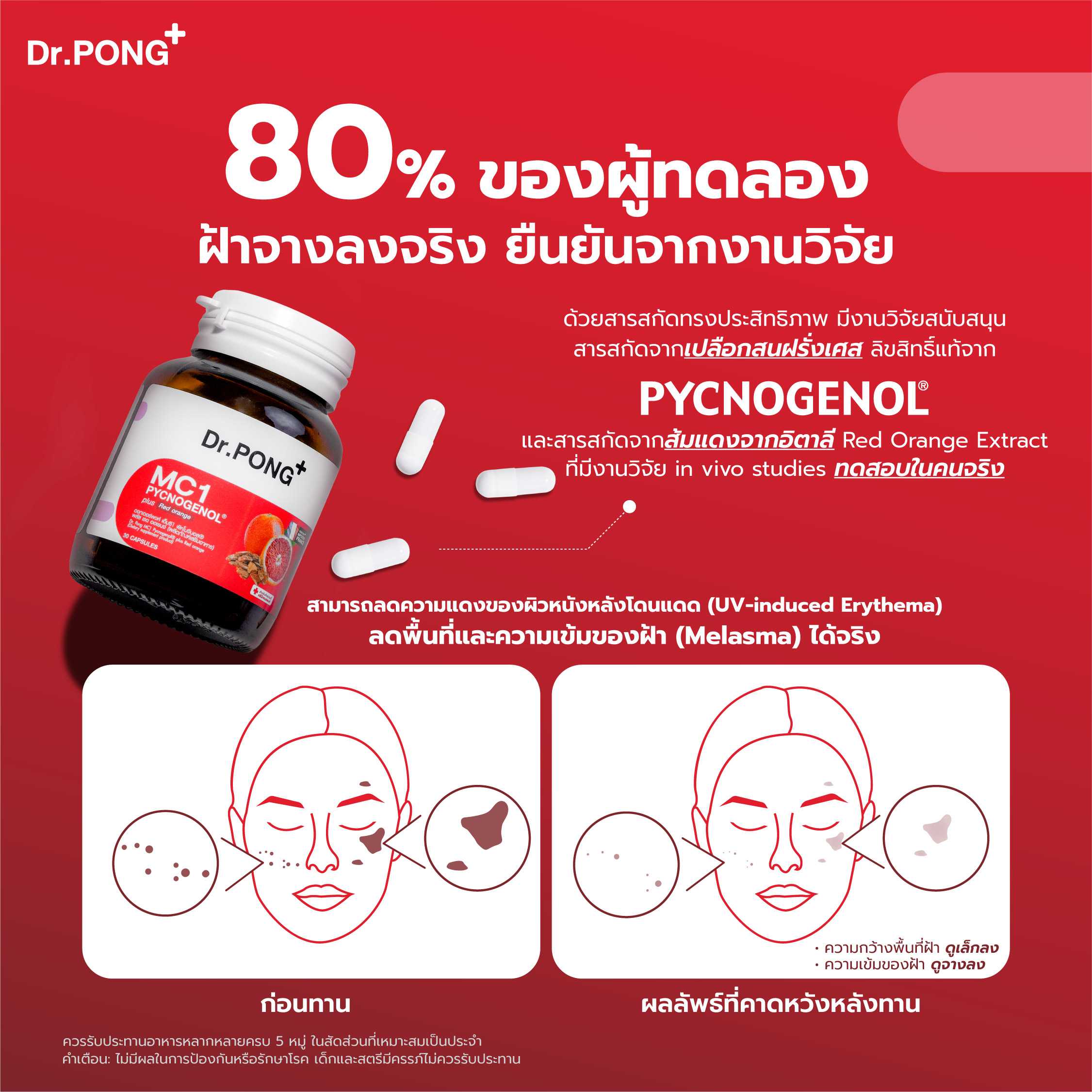 Dr.PONG MC1 PYCNOGENOL plus Red orange extract อาหารเสริมสำหรับคนเป็น ...